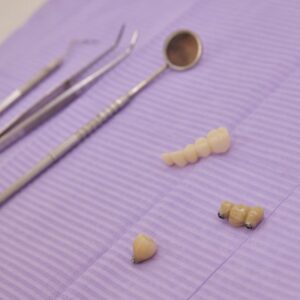 implantes dentales
