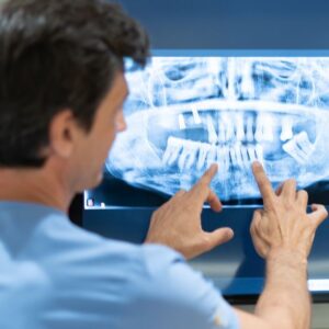 implantes dentales