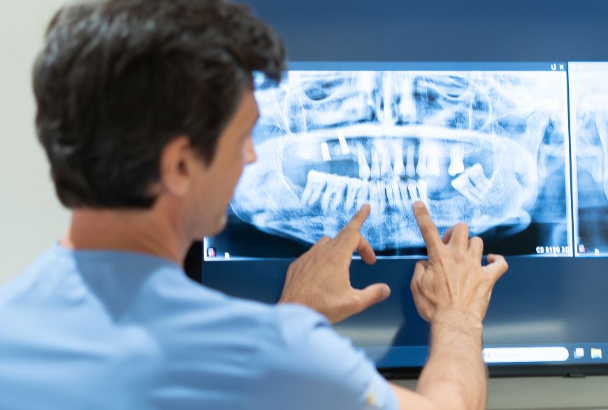 implantes dentales