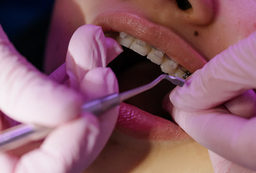 ¿Mi ortodoncia funciona correctamente?